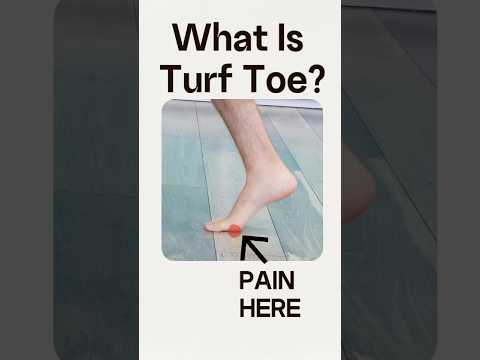🦶What Is Turf Toe?