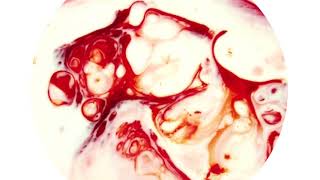 Watter - Death Knock (Official Video)