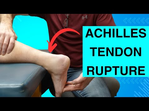 Metatarsalgia and Morton s Neuroma Evaluation and Treatment