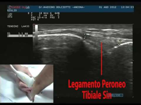 Cervicale distrazione osteocondrosi Girato nel trattamento del collo