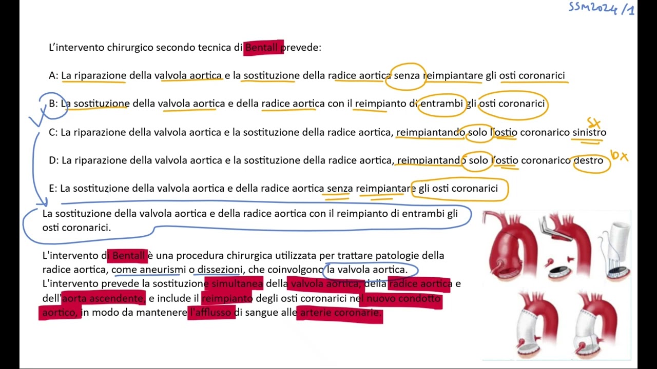 SSM 2024 Domanda Ufficiale n.1 - Spiegazione Completa + Domanda Facsimile