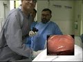 11 hands on Colonoscopy course part 40