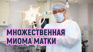 Множественная миома матки