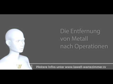 Pickel am Hals tut nicht weh Die Behandlung der Lendenlordose