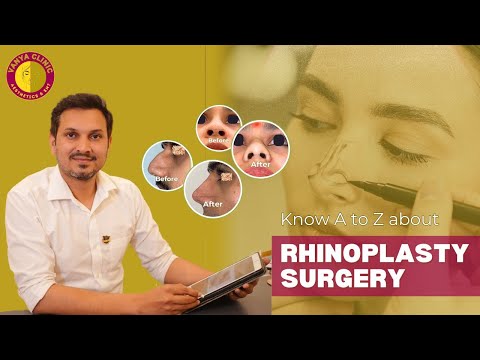 Rhinoplasty explained 