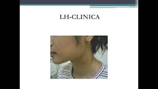 Sindromes Linfoproliferativos