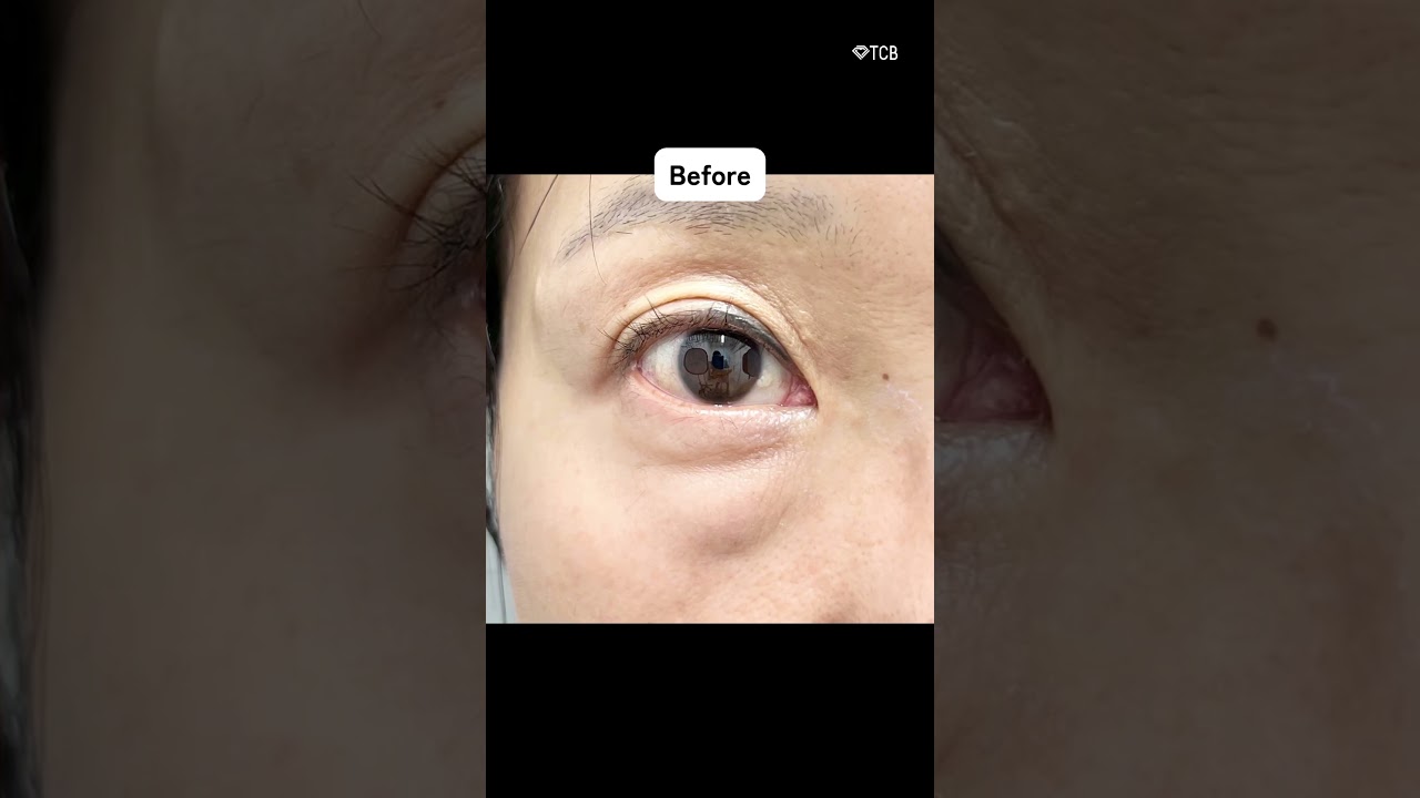 Youtubeのサムネイル