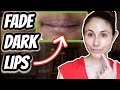 HOW TO FADE DARK LIPS Dr Dray