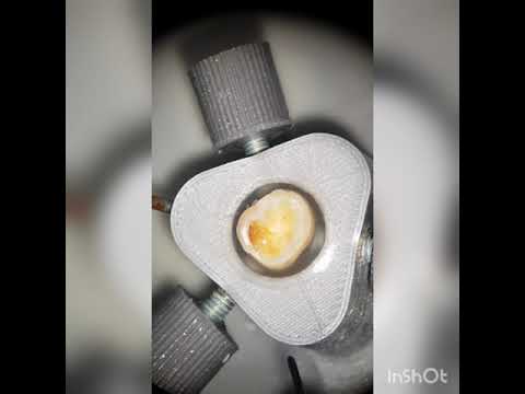 Access cavity preparation Demonstration using EndoTools by Dr Sanil Natekar.