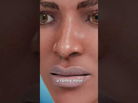 She Thought It Was Just A Runny Nose 😨