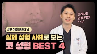 코 성형 전후 변화 BEST4! 직접 보고도 믿기 어려운 코 성형 사례! 이렇게나 바뀌는 거 실화임? (ft. 마인드성형외과 - 이영택 원장님)