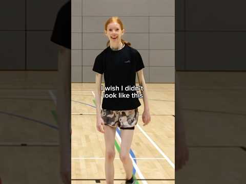 the transformation is insane…🤯