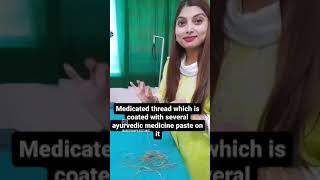 Download lagu World famous  kshar sutra thread treatment for fistula, piles and pilonidal sinus in Chandigarh mp3