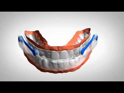 How Narval CC is made