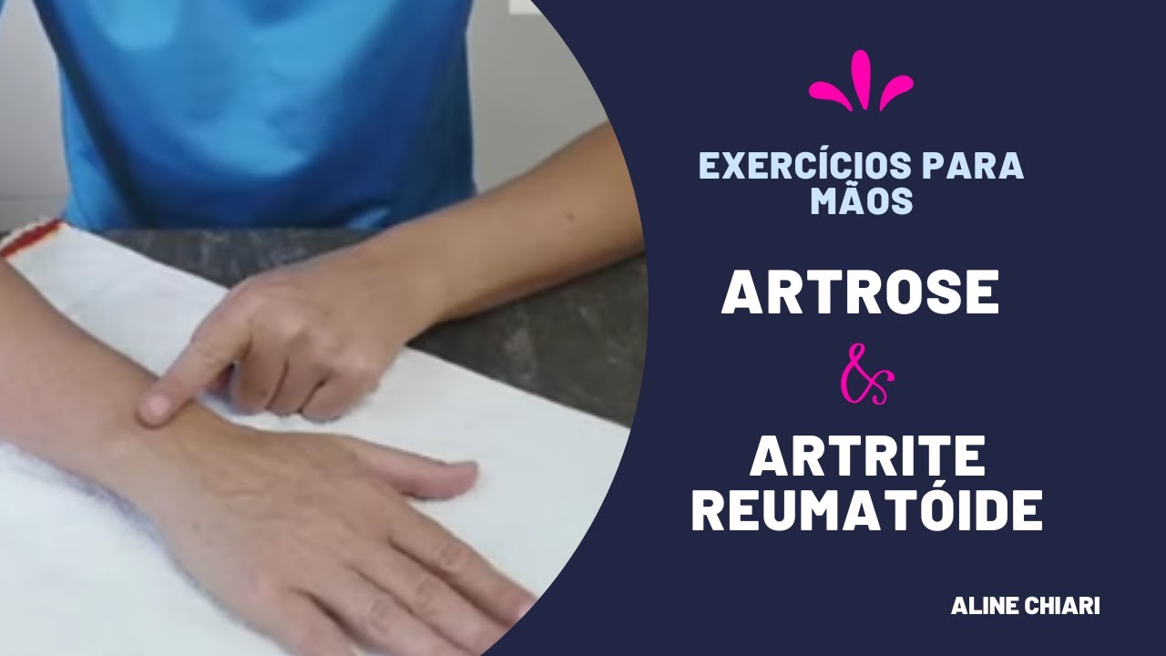Exercícios para artrose de mão e artrite reumatoide | Aline Chiari