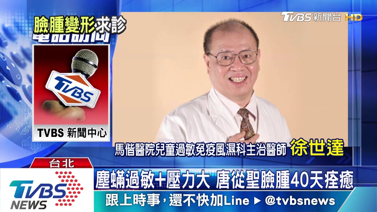 5月患怪病! 唐從聖臉腫變形求診40天痊癒