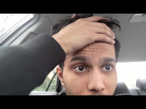 I'm 19 & Balding 😭 (Hairline Reveal)