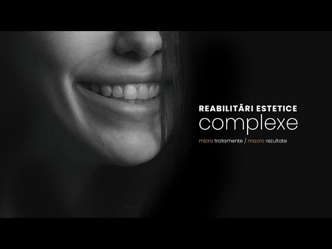 Reabilitări estetice complexe | Mb Dental