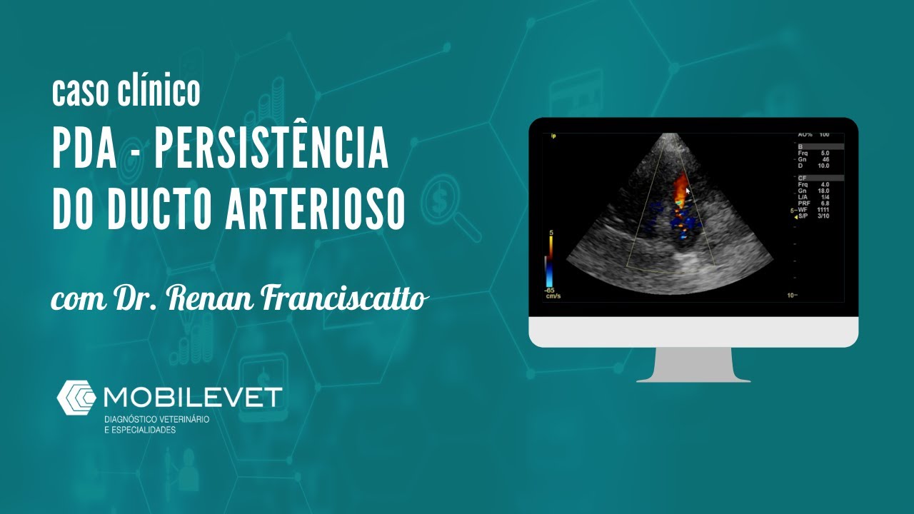PDA - persistência do ducto arterioso - caso clínico