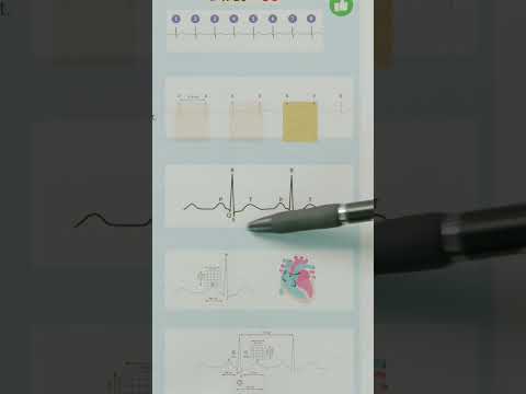 5-Step EKG Interpretation!🫀#nclex #nursing #nursingstudent #nurselife #nclex_rn #ekg #nclexprep