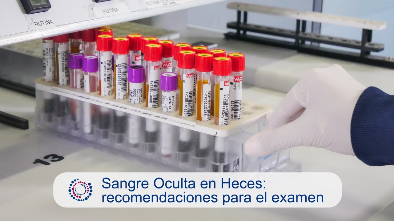 Sangre Oculta en Heces: recomendaciones para el examen