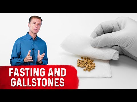 Fasting and Gallstones