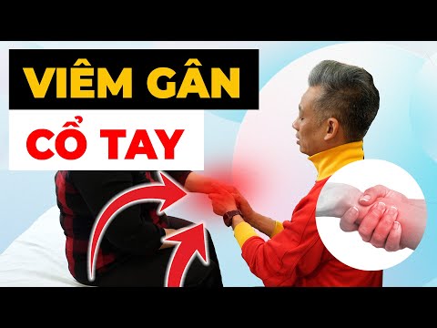 Viêm Gân Cổ Tay Đang ÂM THẦM HỦY HOẠI Cuộc Sống - GIẢI PHÁP KHẨN CẤP!