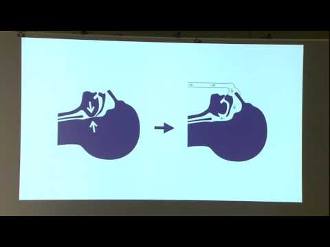 持続的陽圧換気 - 定義