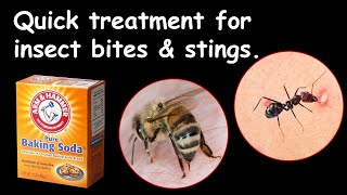 Quick treatment  for insect stings or bites - Home remedy (Baking Soda Treatment)