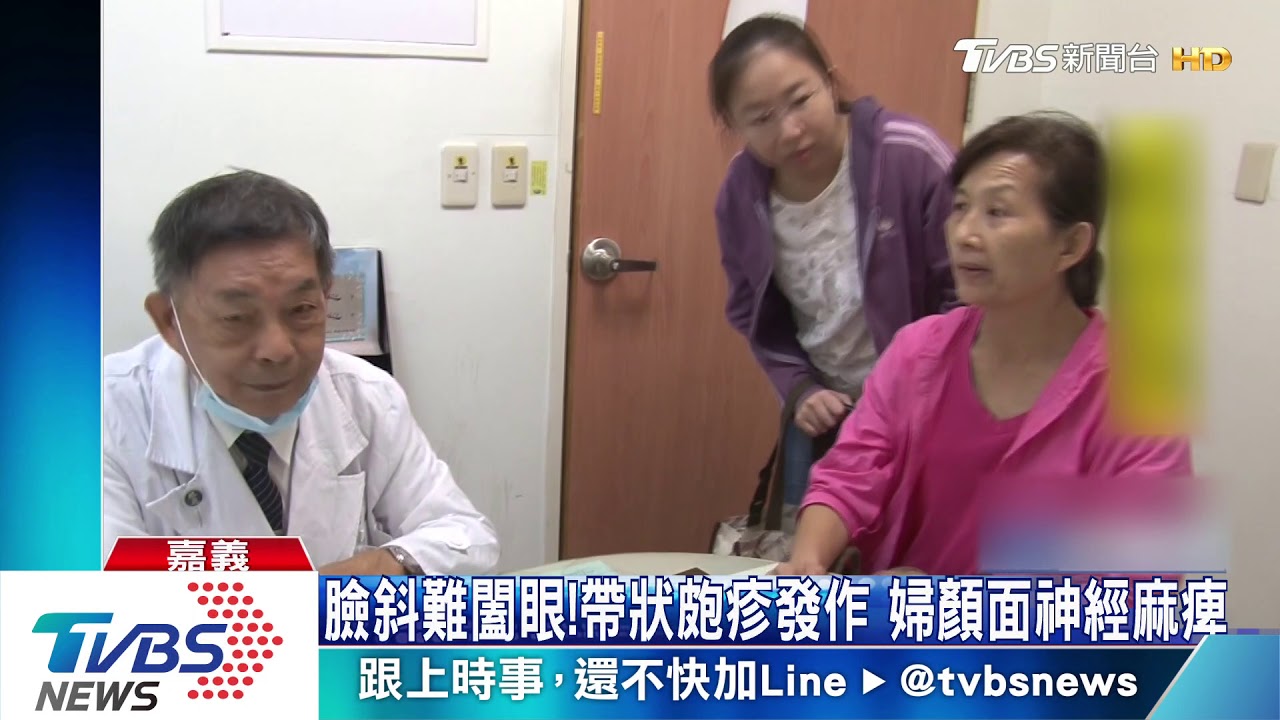 臉斜難闔眼!帶狀皰疹發作 婦顏面神經麻痺