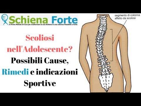 Per giunti y Trattamento osteocondrosi cervicale dei sintomi di vertigini
