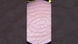 Download lagu Hand Under Microscope | TULO - Microscope #shorts #microscope #hand #underthemicroscope #bacteria mp3