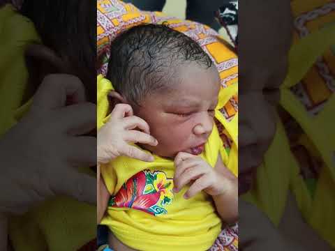 #miliaria crystallina #newborn#sncu #dermatology#pediatric dermatology