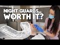 Are Night Guards REALLY Worth It