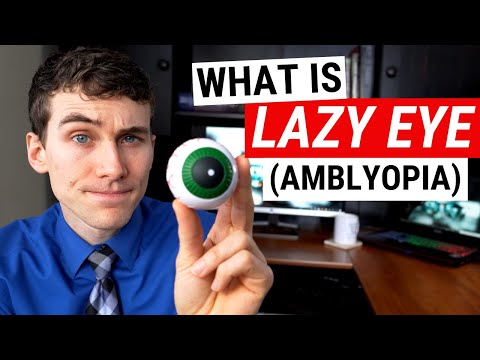 amblyopia homályos látás