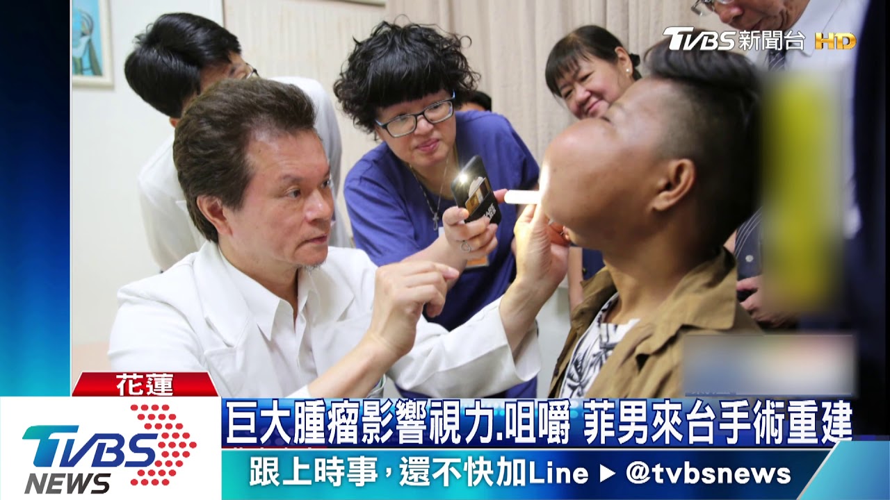 臉上巨大腫瘤 花蓮慈濟助菲男變臉成功
