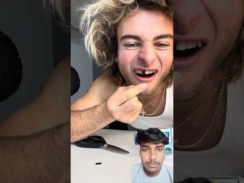 TOPPER GUILD LOSES TOOTH PRANK - #Shorts