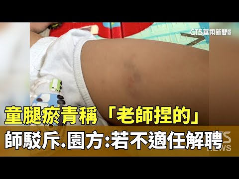 童腿瘀青稱「老師捏的」　師駁斥　園方：若不適任解聘