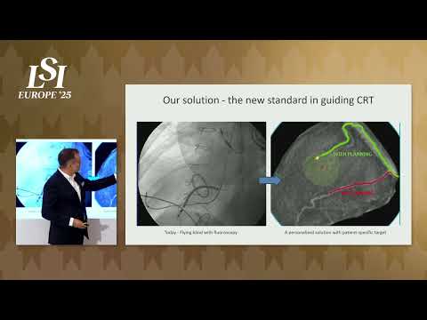 Marcin Golebicki, EP Solutions - Cardiac Electrophysiology Diagnostics | LSI Europe '25