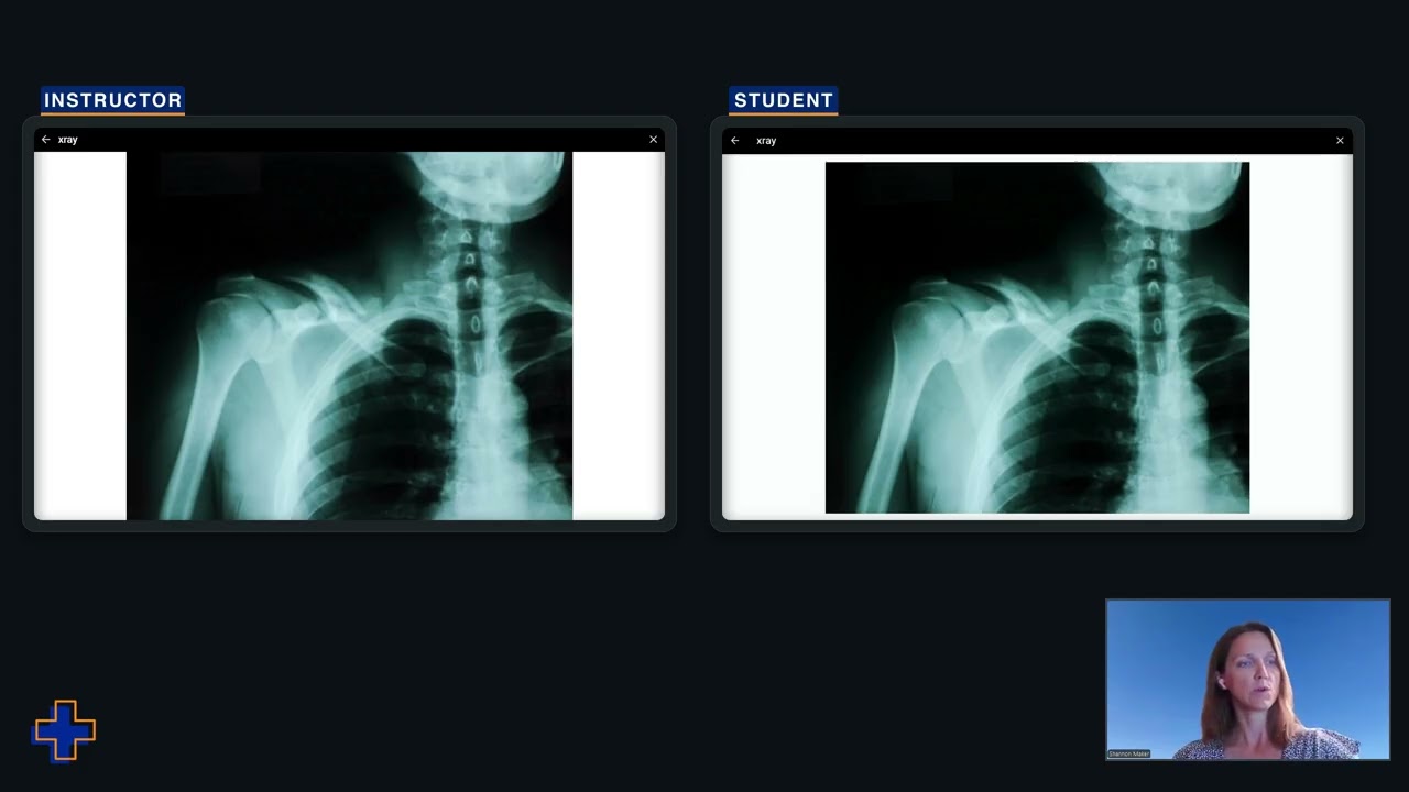 SimVS Hospital Series: Advanced Patient Monitoring Simulation