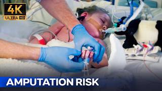4-Year-Old's Fight Against Septic Shock | Hospital 4K