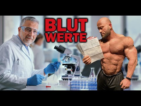 BLUTWERTE für Sportler - was kostet es, wo bekomme ich sie und wann sind sie besonders wichtig?