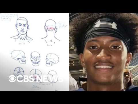 What Nolan Wells' preliminary independent autopsy findings revealed about his death