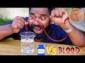My Blood Vs Hydrogen Peroxide രക്തം വെച്ചുള്ള കളി M4 Tech