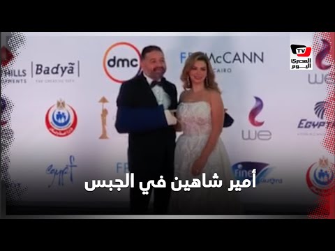أمير شاهين الجبس مش راضي يتفك شكلي محسود