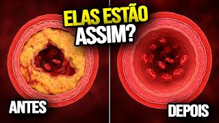Suas ARTÉRIAS podem estar SOFRENDO
