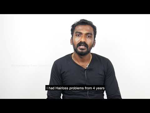 My Hair Transplantation Experience At Richardsons - Patients Testimonial In Tamil