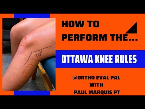 Modified Lachman s Test On a patient with a COMPLETE ACL TEAR