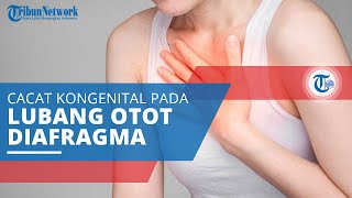 Hernia Diafragmatika, Cacat Kongenital yang Terdapat Sebuah Lubang pada Otot Diafragma