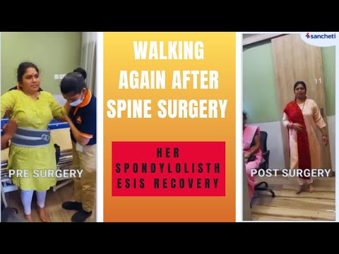 Walking Again After Spine Surgery | Dr. Ajay Kothari